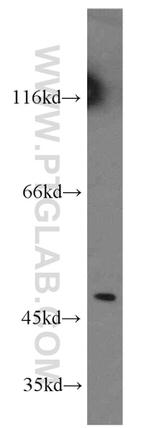 EIF4A3 Antibody in Western Blot (WB)