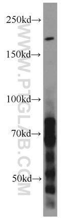 LAMA4 (Isoform 3) Antibody in Western Blot (WB)