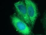 CXCL14 Antibody in Immunocytochemistry (ICC/IF)