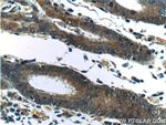 CXCL14 Antibody in Immunohistochemistry (Paraffin) (IHC (P))