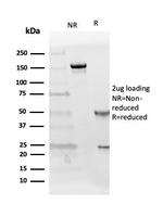 Follistatin/Activin Binding Protein Antibody in SDS-PAGE (SDS-PAGE)