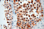 RAN Antibody in Immunohistochemistry (Paraffin) (IHC (P))