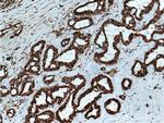 RAN Antibody in Immunohistochemistry (Paraffin) (IHC (P))