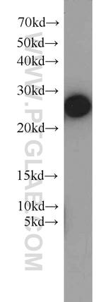 RAN Antibody in Western Blot (WB)