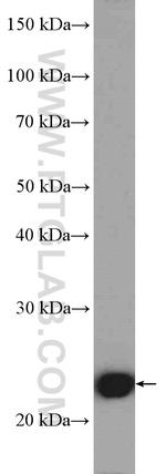 RAN Antibody in Western Blot (WB)