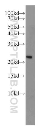 RAN Antibody in Western Blot (WB)