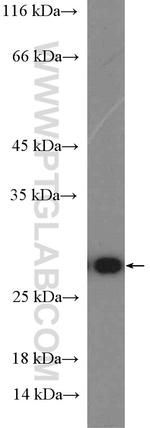 RAN Antibody in Western Blot (WB)