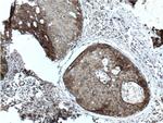 CLINT1 Antibody in Immunohistochemistry (Paraffin) (IHC (P))