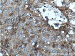 CLINT1 Antibody in Immunohistochemistry (Paraffin) (IHC (P))