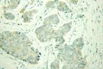 Seladin 1 Antibody in Immunohistochemistry (Paraffin) (IHC (P))