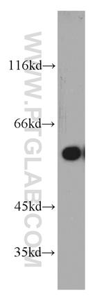 Seladin 1 Antibody in Western Blot (WB)