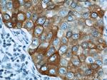 Seladin 1 Antibody in Immunohistochemistry (Paraffin) (IHC (P))