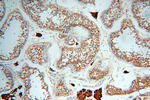 Seladin 1 Antibody in Immunohistochemistry (Paraffin) (IHC (P))