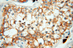 Seladin 1 Antibody in Immunohistochemistry (Paraffin) (IHC (P))