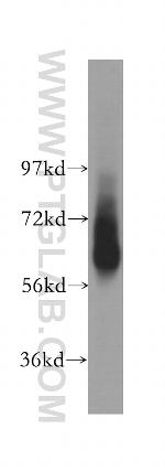 Seladin 1 Antibody in Western Blot (WB)