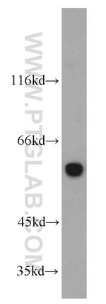 Seladin 1 Antibody in Western Blot (WB)