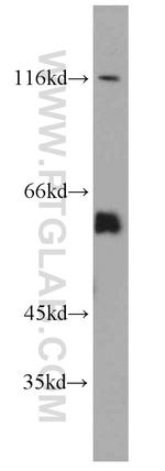 Seladin 1 Antibody in Western Blot (WB)