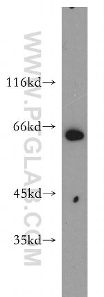 Seladin 1 Antibody in Western Blot (WB)