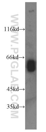 Seladin 1 Antibody in Western Blot (WB)