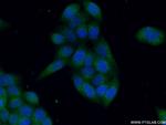 PTPN23 Antibody in Immunocytochemistry (ICC/IF)