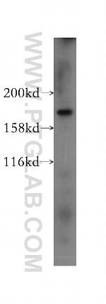 PTPN23 Antibody in Western Blot (WB)