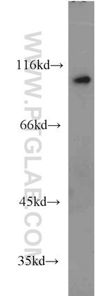 USP5 Antibody in Western Blot (WB)