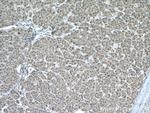 CHMP2A Antibody in Immunohistochemistry (Paraffin) (IHC (P))