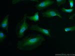 IRAK1 Antibody in Immunocytochemistry (ICC/IF)