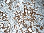 IRAK1 Antibody in Immunohistochemistry (Paraffin) (IHC (P))