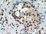 IRAK1 Antibody in Immunohistochemistry (Paraffin) (IHC (P))