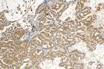 IRAK1 Antibody in Immunohistochemistry (Paraffin) (IHC (P))