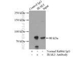 IRAK1 Antibody in Immunoprecipitation (IP)