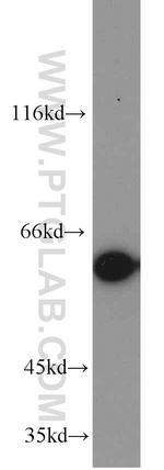 Annexin A11 Antibody in Western Blot (WB)