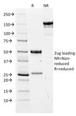 Carcinoembryonic Antigen (CEA)/CD66 Antibody in SDS-PAGE (SDS-PAGE)