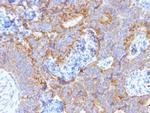 Carcinoembryonic Antigen (CEA)/CD66 Antibody in Immunohistochemistry (Paraffin) (IHC (P))