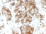 Carcinoembryonic Antigen (CEA)/CD66 Antibody in Immunohistochemistry (Paraffin) (IHC (P))