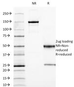 Carcinoembryonic Antigen (CEA)/CD66 Antibody in SDS-PAGE (SDS-PAGE)