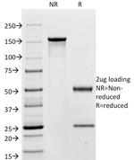 Carcinoembryonic Antigen (CEA)/CD66 Antibody in SDS-PAGE (SDS-PAGE)