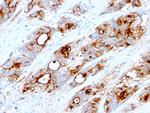 Carcinoembryonic Antigen (CEA)/CD66 Antibody in Immunohistochemistry (Paraffin) (IHC (P))