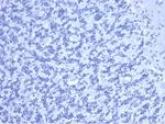 Carcinoembryonic Antigen (CEA)/CD66 Antibody in Immunohistochemistry (Paraffin) (IHC (P))