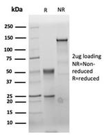 Carcinoembryonic Antigen (CEA)/CD66 Antibody in SDS-PAGE (SDS-PAGE)