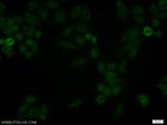 JUNB Antibody in Immunocytochemistry (ICC/IF)