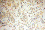 JUNB Antibody in Immunohistochemistry (Paraffin) (IHC (P))