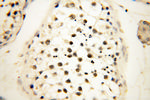 JUNB Antibody in Immunohistochemistry (Paraffin) (IHC (P))