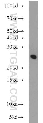 STARD5 Antibody in Western Blot (WB)