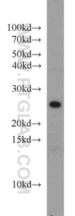 STARD5 Antibody in Western Blot (WB)