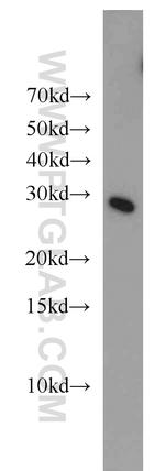 STARD5 Antibody in Western Blot (WB)