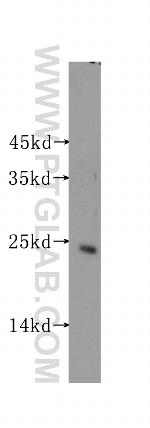 STARD5 Antibody in Western Blot (WB)