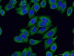 S100A14 Antibody in Immunocytochemistry (ICC/IF)