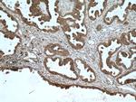 S100A14 Antibody in Immunohistochemistry (Paraffin) (IHC (P))